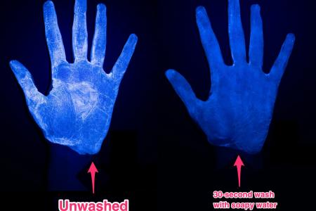 Hand Sanitizer or Hand Washing, Which is More Effective?